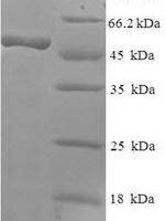 Human Rab effector Noc2 (RPH3AL) Recombinant Protein - BioCrest Sci