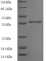 Human Uncharacterized protein C11orf73 (C11orf73) Recombinant Protein - BioCrest Sci