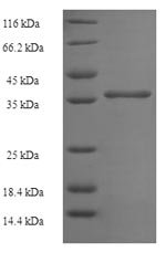 Human Uncharacterized protein C11orf73 (C11orf73) Recombinant Protein, Homo sapiens (Human), E.coli, N-terminal 6xHis-SUMO-tagged, 37.6 kDa, purity >≥ 90% as determined by SDS-PAGE.