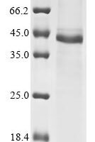 Human coronavirus HKU1 Spike glycoprotein (S), partial Recombinant Protein, N-10His/C-Myc - BioCrest Sci