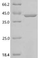Drosophila melanogaster Nucleoside diphosphate kinase (awd) Recombinant Protein - BioCrest Sci