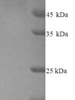 Human Protein-arginine deiminase type-2 (PADI2) Recombinant Protein, N-His - BioCrest Sci