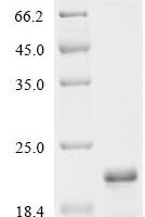 Human Progesterone receptor (PGR), partial Recombinant Protein - BioCrest Sci