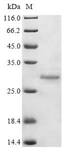 Avian infectious bronchitis virus Replicase polyprotein 1ab (rep), partial Recombinant Protein, Avian infectious bronchitis virus (strain KB8523) (IBV), Mammalian cell, C-terminal 6xHis-tagged, 26.9 kDa, purity >≥ 85% as determined by SDS-PAGE.