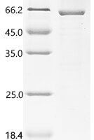 Crimean-Congo hemorrhagic fever virus Nucleoprotein (N) Recombinant Protein, C-His - BioCrest Sci