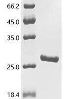 Pseudomonas aeruginosa PopB (popB), partial Recombinant Protein - BioCrest Sci
