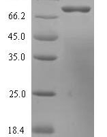 Human Histidine decarboxylase (HDC) Recombinant Protein - BioCrest Sci