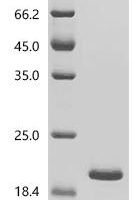 Human Integrin alpha-M (ITGAM), partial Recombinant Protein, C-His - BioCrest Sci