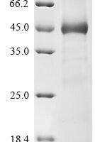 Human Ubl carboxyl-terminal hydrolase 18 (USP18) Recombinant Protein, N-His - BioCrest Sci