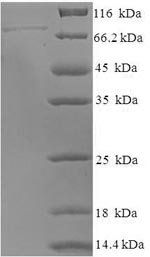 Human DNA-directed RNA polymerase III subunit RPC3 (POLR3C) Recombinant Protein, Homo sapiens (Human), E.coli, N-terminal 6xHis-SUMO-tagged, 76.6 kDa, purity >≥ 90% as determined by SDS-PAGE.