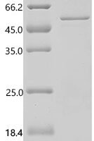 Human Stromelysin-3 (MMP11) Recombinant Protein - BioCrest Sci