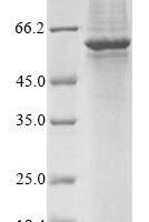 Human Gasdermin-C (GSDMC) Recombinant Protein - BioCrest Sci