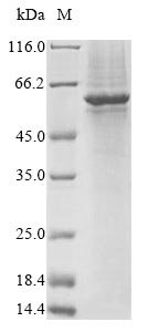 Human Gasdermin-C (GSDMC) Recombinant Protein, Homo sapiens (Human), Baculovirus, N-terminal 10xHis-tagged and C-terminal Myc-tagged, 61.7 kDa, purity >≥ 85% as determined by SDS-PAGE.