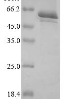 Gossypium hirsutum homeobox protein knotted-1-like 6 (LOC107939280) Recombinant Protein - BioCrest Sci