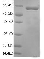 Rat Perforin-1 (Prf1), partial Recombinant Protein - BioCrest Sci