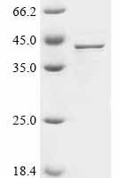 Human Gastric triacylglycerol lipase (LIPF) Recombinant Protein - BioCrest Sci