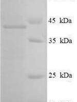 Human Ras-related protein Rab-3C (RAB3C) Recombinant Protein - BioCrest Sci