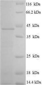 Human Ras-related protein Rab-3C (RAB3C) Recombinant Protein, Homo sapiens (Human), E.coli, N-terminal 6xHis-SUMO-tagged, 42.0 kDa, purity >≥ 90% as determined by SDS-PAGE.