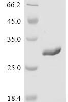 Rat Odorant-binding protein(Obp1f) Recombinant Protein - BioCrest Sci