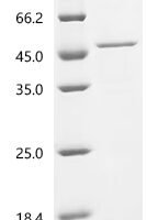 Human Sialidase-2 (NEU2) Recombinant Protein, C-His, aa 1–380, E.coli - BioCrest Sci