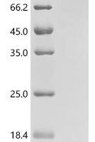 Bovine Transthyretin (TTR) Recombinant Protein, C-10His - BioCrest Sci