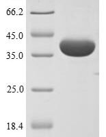 Influenza A virus Hemagglutinin (HA) Recombinant Protein, N-His - BioCrest Sci