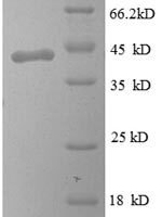 Human Myelin P2 protein (PMP2) Recombinant Protein - BioCrest Sci