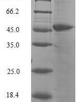 Human HemK methyltransferase family member 2 (N6AMT1) Recombinant Protein - BioCrest Sci