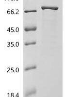 Escherichia coli Small ribosomal subunit protein bS1 (rpsA) Recombinant Protein - BioCrest Sci