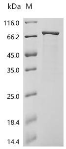 Escherichia coli Small ribosomal subunit protein bS1 (rpsA) Recombinant Protein, Escherichia coli (strain K12), E.coli, C-terminal 6xHis-tagged, 68.1 kDa, purity >≥ 85% as determined by SDS-PAGE.