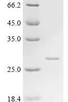 Pig Tenascin (TNC), partial Recombinant Protein, C-His, aa 1520–1735, Yeast - BioCrest Sci