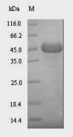 Escherichia coli Lipid kinase YegS (yegS) Recombinant Protein, Escherichia coli (strain K12), E.coli, N-terminal 6xHis-SUMO-tagged, 48.0 kDa, purity >≥ 90% as determined by SDS-PAGE.