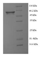 Clostridioides difficile NAD-specific glutamate dehydrogenase (gluD) Recombinant Protein, N-His-SUMO - BioCrest Sci