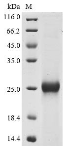 Bovine coronavirus Spike glycoprotein (S), partial Recombinant Protein, C-His, aa 326–540, strain Mebus, Bovine coronavirus (strain Mebus) (BCoV) (BCV), E.coli, C-terminal 6xHis-tagged, 24.7 kDa, purity >≥ 85% as determined by SDS-PAGE.