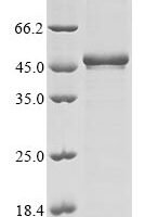 Human Programmed cell death protein 2 (PDCD2) Recombinant Protein - BioCrest Sci