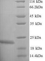 Escherichia coli O6:H1 Lipopolysaccharide export system protein LptC (lptC) Recombinant Protein, N-His - BioCrest Sci
