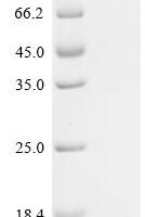 Mouse Netrin-1 (Ntn1) Recombinant Protein - BioCrest Sci