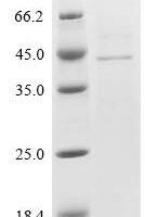 Porcine reproductive and respiratory syndrome viru Glycoprotein 2a (GP2a), partial Recombinant Protein - BioCrest Sci