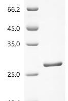 Human Protein AF-9 (MLLT3), partial Recombinant Protein - BioCrest Sci