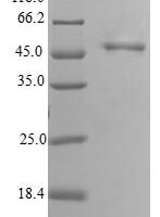 Human Calcineurin subunit B type 2 (PPP3R2) Recombinant Protein - BioCrest Sci