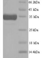 Mouse Heme oxygenase 1 (Hmox1) Recombinant Protein, N-His - BioCrest Sci