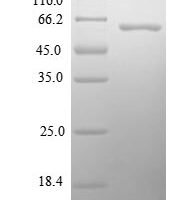 Human Paraneoplastic antigen-like protein 5 (PNMA5), partial Recombinant Protein - BioCrest Sci