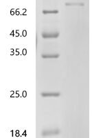 Human Inhibin beta C chain (INHBC) Recombinant Protein - BioCrest Sci