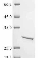 Human Zinc finger MYM-type protein 2 (ZMYM2), partial Recombinant Protein - BioCrest Sci