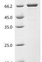 Rat 72 kDa type IV collagenase (Mmp2) Recombinant Protein, N-His, aa 110–662, E.coli - BioCrest Sci