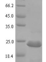 Escherichia coli Translational regulator CsrA (csrA) Recombinant Protein, N-His-SUMO - BioCrest Sci