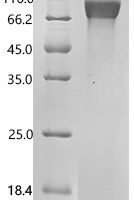 Mouse Platelet-derived growth factor receptor alpha (Pdgfra), partial Recombinant Protein - BioCrest Sci