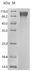 Mouse Platelet-derived growth factor receptor alpha (Pdgfra), partial Recombinant Protein, Mus musculus (Mouse), Mammalian cell, C-terminal 10xHis-tagged, 57.8 kDa, purity >≥ 95% as determined by SDS-PAGE.