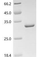 Dog Transferrin receptor protein 1 (TFRC), partial Recombinant Protein - BioCrest Sci