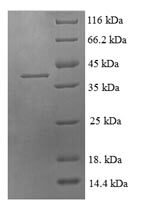 Human C-C motif chemokine 21 (CCL21) Recombinant Protein, N-GST - BioCrest Sci